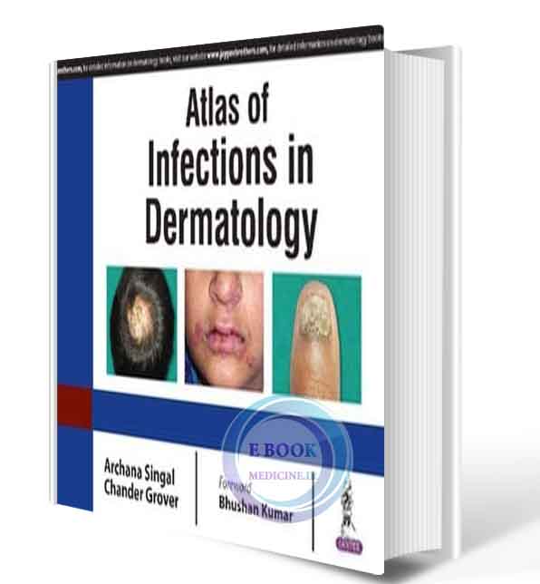 دانلود کتاب Atlas Of Infections In Dermatology 2019 (ORIGINAL PDF)